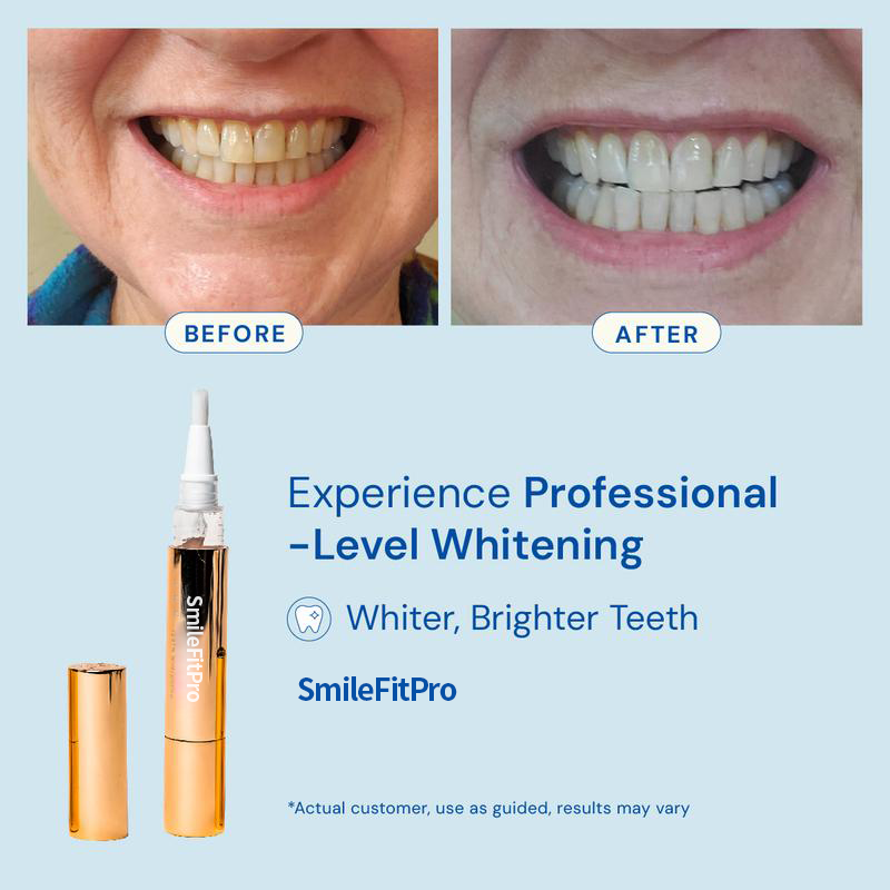 SmileFitPro™ Teeth Whitening Essence