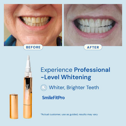 SmileFitPro™ Teeth Whitening Essence