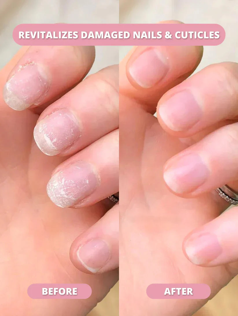 Nail Growth Pen™