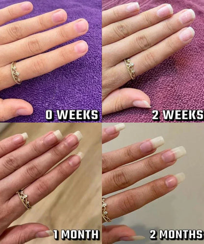 Nail Growth Pen™